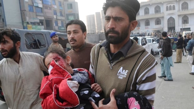 A girl injured in the Taliban attack is rushed to a hospital in Peshawar. (Mohammad Sajjad/Associated Press). Source: www.cbc.ca