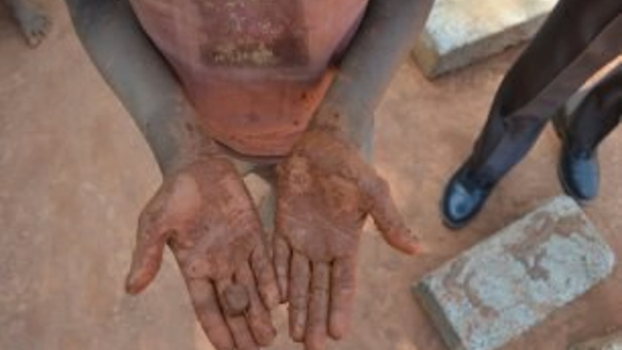 800 bangalorebrickkiln 1