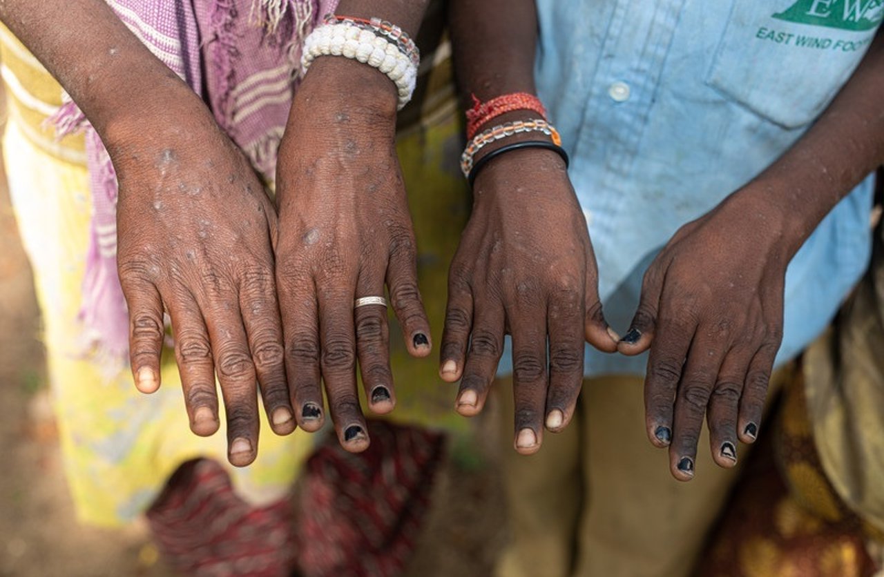 K4 A7287 201907 CHE Natraj and Prashanth Wood Cutting Rescues Approved for Full Use